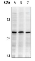 DNA Polymerase lambda Rabbit Polyclonal Antibody