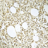 DNA Polymerase lambda Rabbit Polyclonal Antibody