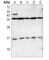 CD247 Rabbit Polyclonal Antibody