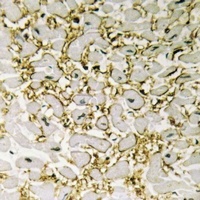 CD247 Rabbit Polyclonal Antibody