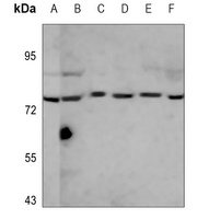 CD19 Rabbit Polyclonal Antibody