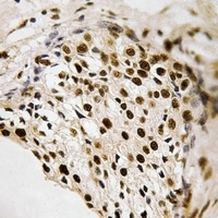 PRAK (Phospho-T182) Rabbit Polyclonal Antibody