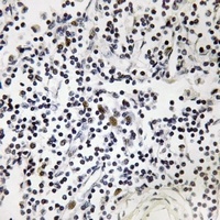 OCT1 (Phospho-S385) Rabbit Polyclonal Antibody