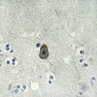 ROMK1 (Phospho-S44) Rabbit Polyclonal Antibody