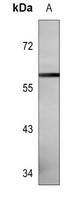 CD129 (Phospho-S519) Rabbit Polyclonal Antibody