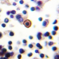 CD129 (Phospho-S519) Rabbit Polyclonal Antibody
