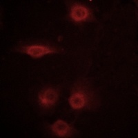 CD129 (Phospho-S519) Rabbit Polyclonal Antibody