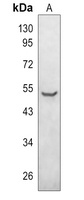Parkin (Phospho-S131) Rabbit Polyclonal Antibody