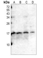CD247 (Phospho-Y142) Rabbit Polyclonal Antibody
