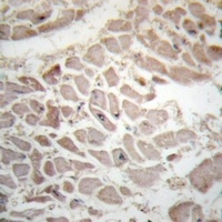 CD247 (Phospho-Y142) Rabbit Polyclonal Antibody