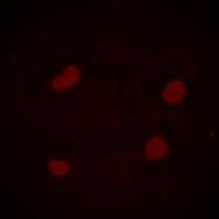 Histone H3 (Acetyl-K14) Rabbit Polyclonal Antibody