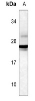 GH1/2 Rabbit Polyclonal Antibody