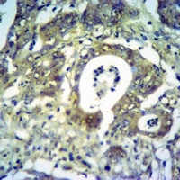 GH1/2 Rabbit Polyclonal Antibody