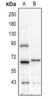 IFNAR1 Rabbit Polyclonal Antibody