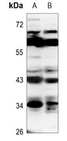 CD83 Rabbit Polyclonal Antibody