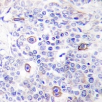 CD83 Rabbit Polyclonal Antibody