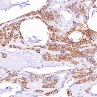 Goat Anti-Mouse/Rabbit IgG (H&L)- Polymer (Ready to use) Antibody (HRP)