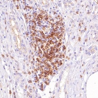 Goat Anti-Mouse/Rabbit IgG (H&L)- Polymer (Ready to use) Antibody (HRP)