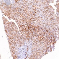 Goat Anti-Rabbit IgG (H&L)- Polymer (Ready to use) Antibody (HRP)