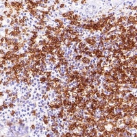 Goat Anti-Mouse IgG (H&L)- Polymer (Ready to use) Antibody (HRP)