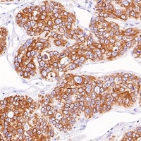 Goat Anti-Mouse/Rabbit IgG (H&L)- Polymer Antibody (HRP)