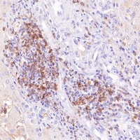 Goat Anti-Mouse/Rabbit IgG (H&L)- Polymer Antibody (HRP)