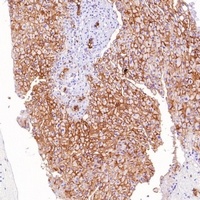Goat Anti-Rabbit IgG (H&L)- Polymer Antibody (HRP)