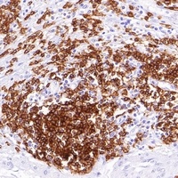 Goat Anti-Mouse IgG (H&L)- Polymer Antibody (HRP)