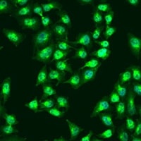 RSAD2 Rabbit Polyclonal Antibody