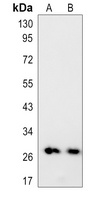 FGF23 Rabbit Polyclonal Antibody