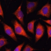 TMX2 Rabbit Polyclonal Antibody