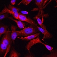 STAT6 Rabbit Polyclonal Antibody