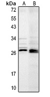 TWEAK Rabbit Polyclonal Antibody