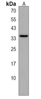 s1pr2 Rabbit Polyclonal Antibody