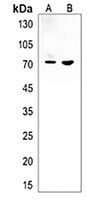 mtmr14 Rabbit Polyclonal Antibody