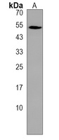gfap Rabbit Polyclonal Antibody