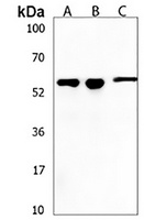 KLHL20 Rabbit Polyclonal Antibody
