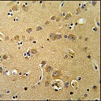 KLHL20 Rabbit Polyclonal Antibody