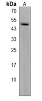 AAGAB Rabbit Polyclonal Antibody