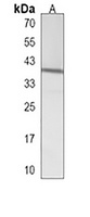 NIPAL2 Rabbit Polyclonal Antibody