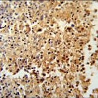 STAMBPL1 Rabbit Polyclonal Antibody