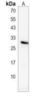 RSPO2 Rabbit Polyclonal Antibody