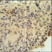 RSPO2 Rabbit Polyclonal Antibody