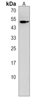 CNOT6L Rabbit Polyclonal Antibody