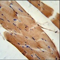 CNOT6L Rabbit Polyclonal Antibody