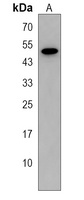 FOLH1B Rabbit Polyclonal Antibody