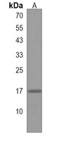 GLRX5 Rabbit Polyclonal Antibody