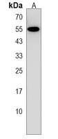 POTEH Rabbit Polyclonal Antibody