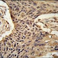 PRG1 Rabbit Polyclonal Antibody