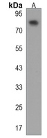PAN3 Rabbit Polyclonal Antibody